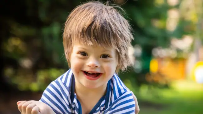 Angelman Syndrome